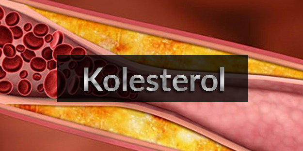 kolesterol